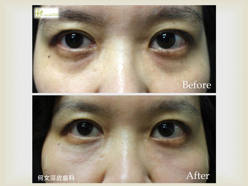 http://www.linkouhoskin.com.tw/Files/201601120041431.jpg