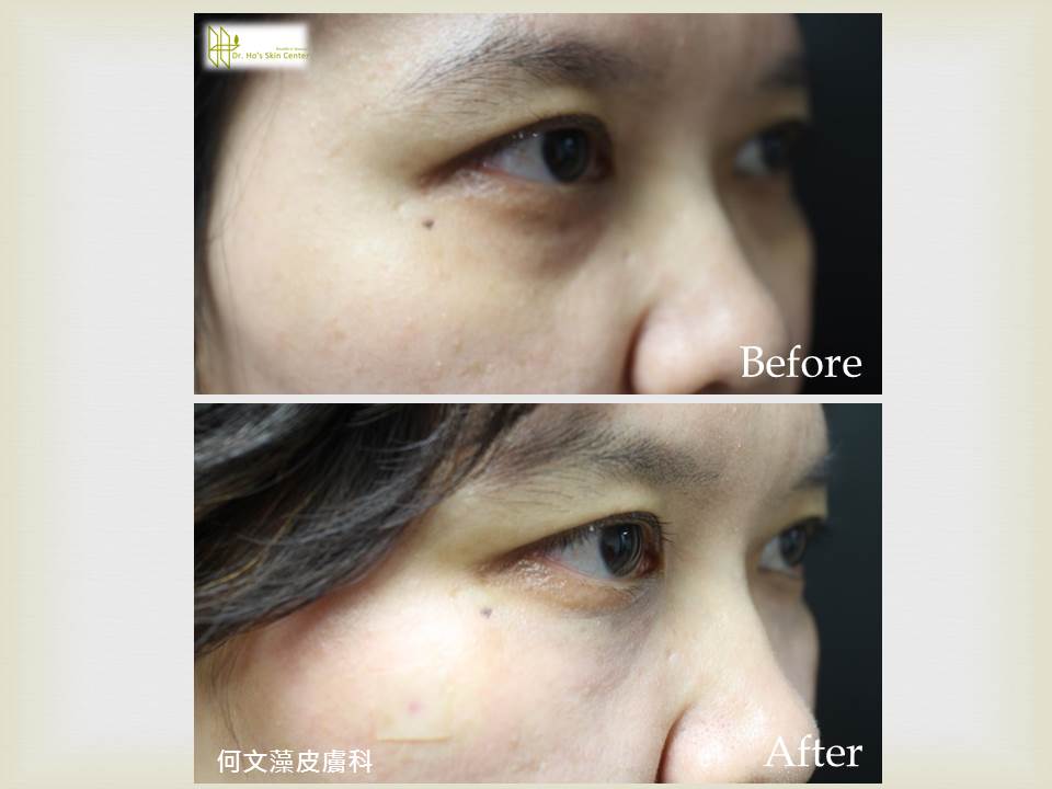 http://www.linkouhoskin.com.tw/Files/201601120041432.jpg