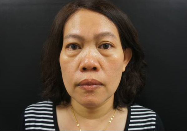 http://www.linkouhoskin.com.tw/Files/201606071705214.JPG